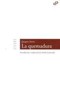 La quemadura