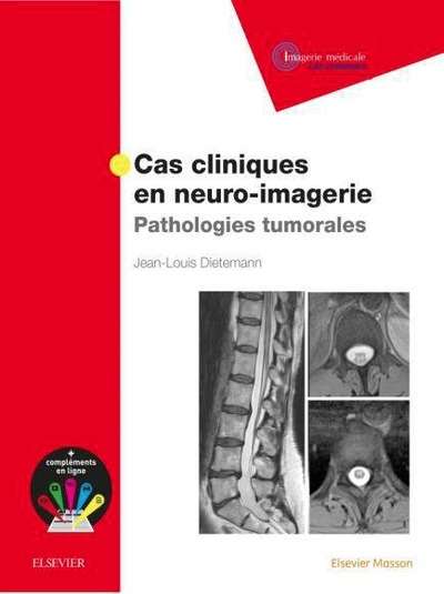 Cas cliniques en neuro-imagerie