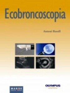 Ecobroncoscopia