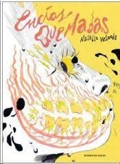 Encías quemadas